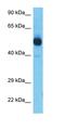 Serine/Threonine Kinase 32B antibody, orb326170, Biorbyt, Western Blot image 