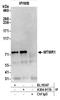 Myotubularin Related Protein 1 antibody, A304-917A, Bethyl Labs, Immunoprecipitation image 