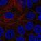 Epithelial Cell Adhesion Molecule antibody, NBP2-56894, Novus Biologicals, Immunocytochemistry image 
