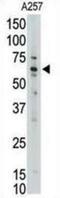 MLLT1 Super Elongation Complex Subunit antibody, abx032717, Abbexa, Western Blot image 