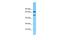 Transmembrane Protein 232 antibody, A17241, Boster Biological Technology, Western Blot image 