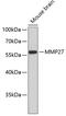 Matrix Metallopeptidase 27 antibody, 18-914, ProSci, Western Blot image 