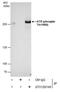 ATR Serine/Threonine Kinase antibody, PA5-77873, Invitrogen Antibodies, Immunoprecipitation image 