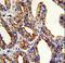 TACSTD2 antibody, LS-C98418, Lifespan Biosciences, Immunohistochemistry paraffin image 