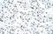 Matrin 3 antibody, NBP1-57359, Novus Biologicals, Immunohistochemistry paraffin image 