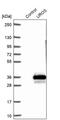 Uroporphyrinogen III Synthase antibody, PA5-60597, Invitrogen Antibodies, Western Blot image 
