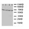 NADPH Oxidase 1 antibody, LS-C312820, Lifespan Biosciences, Western Blot image 