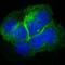 Collagen Type XVII Alpha 1 Chain antibody, M03031, Boster Biological Technology, Immunofluorescence image 