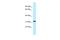 ALG5 Dolichyl-Phosphate Beta-Glucosyltransferase antibody, A10569, Boster Biological Technology, Western Blot image 