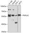 Patatin Like Phospholipase Domain Containing 2 antibody, 22-078, ProSci, Western Blot image 