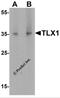 T Cell Leukemia Homeobox 1 antibody, 7361, ProSci, Western Blot image 