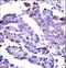 AKT Serine/Threonine Kinase 2 antibody, LS-C98941, Lifespan Biosciences, Immunohistochemistry paraffin image 