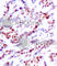 Activating Transcription Factor 2 antibody, AP0130, ABclonal Technology, Immunohistochemistry paraffin image 