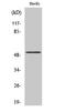 Activating Transcription Factor 2 antibody, STJ90186, St John