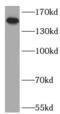 Latent Transforming Growth Factor Beta Binding Protein 1 antibody, FNab04885, FineTest, Western Blot image 