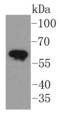 Keratin 5 antibody, A00398-1, Boster Biological Technology, Western Blot image 