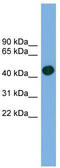 Actin Related Protein T1 antibody, TA340282, Origene, Western Blot image 