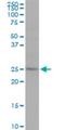 Ras-related protein Rab-7L1 antibody, H00008934-M02, Novus Biologicals, Western Blot image 
