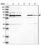 Family With Sequence Similarity 160 Member B2 antibody, PA5-55213, Invitrogen Antibodies, Western Blot image 
