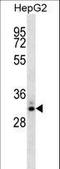 Stanniocalcin 2 antibody, LS-C161551, Lifespan Biosciences, Western Blot image 