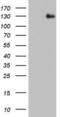 ADAM Metallopeptidase With Thrombospondin Type 1 Motif 1 antibody, LS-C339210, Lifespan Biosciences, Western Blot image 