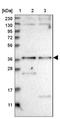 Sorting Nexin 16 antibody, NBP1-85975, Novus Biologicals, Western Blot image 