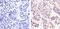 p53 antibody, 44-640G, Invitrogen Antibodies, Immunohistochemistry paraffin image 