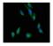 Aldehyde Dehydrogenase 1 Family Member A2 antibody, PB9981, Boster Biological Technology, Immunofluorescence image 