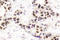 Checkpoint Kinase 2 antibody, LS-C175957, Lifespan Biosciences, Immunohistochemistry frozen image 