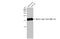 Myosin Light Chain 2 antibody, GTX100888, GeneTex, Western Blot image 