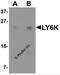 Lymphocyte Antigen 6 Family Member K antibody, 6437, ProSci, Western Blot image 