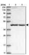 Proteasome 26S Subunit, Non-ATPase 6 antibody, PA5-57871, Invitrogen Antibodies, Western Blot image 