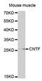 Ciliary Neurotrophic Factor antibody, MBS126893, MyBioSource, Western Blot image 