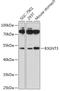 UDP-GlcNAc:BetaGal Beta-1,3-N-Acetylglucosaminyltransferase 3 antibody, 18-003, ProSci, Western Blot image 
