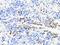 S100 Calcium Binding Protein A9 antibody, GTX64397, GeneTex, Immunohistochemistry paraffin image 