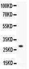 Kallikrein 1 antibody, PA2038, Boster Biological Technology, Western Blot image 