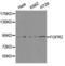 Fibroblast Growth Factor Receptor 2 antibody, LS-C193052, Lifespan Biosciences, Western Blot image 