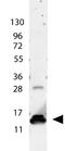 AKT Serine/Threonine Kinase 2 antibody, orb345005, Biorbyt, Western Blot image 