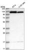 Kinesin Family Member 5B antibody, HPA037589, Atlas Antibodies, Western Blot image 