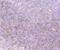 Protein Kinase D2 antibody, NBP2-75629, Novus Biologicals, Immunohistochemistry paraffin image 