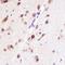 CUGBP Elav-Like Family Member 1 antibody, GTX64547, GeneTex, Immunohistochemistry paraffin image 