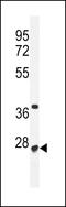 Ribosomal RNA Processing 36 antibody, 55-417, ProSci, Western Blot image 
