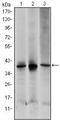 Mitogen-Activated Protein Kinase Kinase 6 antibody, MA5-15808, Invitrogen Antibodies, Western Blot image 