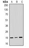 Trefoil Factor 1 antibody, orb388692, Biorbyt, Western Blot image 