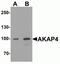 AKAP4 antibody, NBP2-81946, Novus Biologicals, Western Blot image 