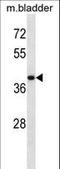 Ubiquitin Specific Peptidase 12 antibody, LS-C160466, Lifespan Biosciences, Western Blot image 