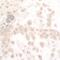 Nicotinamide Phosphoribosyltransferase antibody, NB100-594, Novus Biologicals, Immunohistochemistry paraffin image 