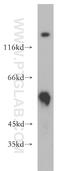 Phosphatidylinositol-5-Phosphate 4-Kinase Type 2 Beta antibody, 13218-1-AP, Proteintech Group, Western Blot image 