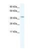 Insulin gene enhancer protein ISL-2 antibody, NBP1-91535, Novus Biologicals, Western Blot image 