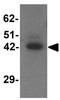 Transmembrane Protein 59 Like antibody, GTX31449, GeneTex, Western Blot image 